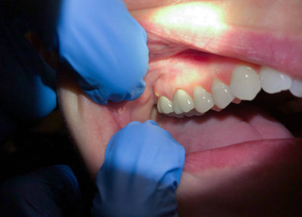 Best Emergency Cosmetic Dentistry in Brevard, NC