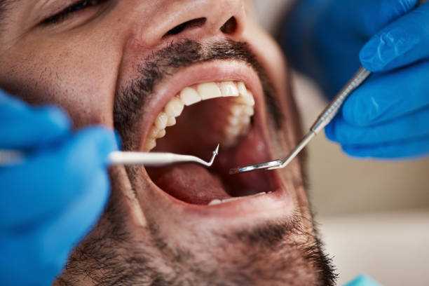 Best Emergency Root Canal Treatment in Brevard, NC
